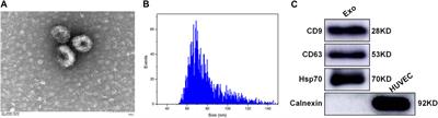 Plasma-derived exosomal let-7c-5p, miR-335–3p, and miR-652–3p as potential diagnostic biomarkers for stable coronary artery disease